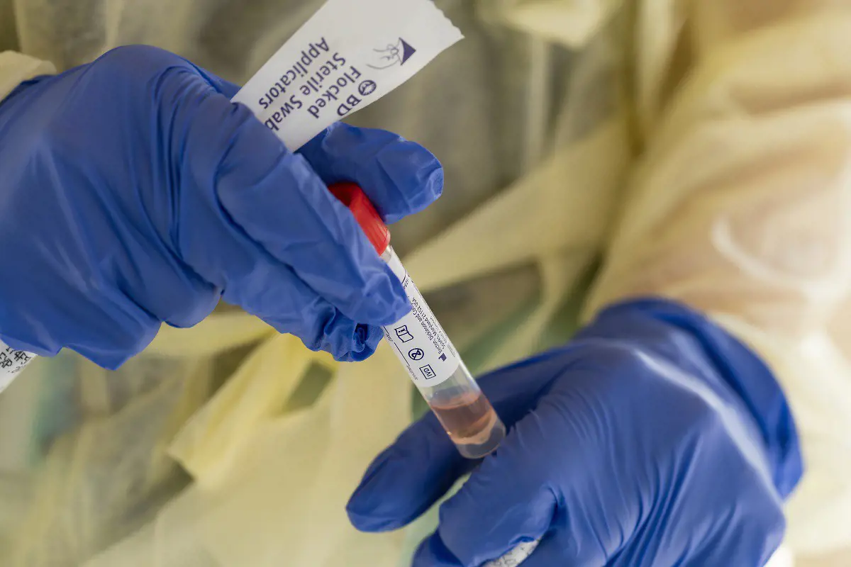 A Semmelweis Egyetem rektora kötelezővé tenné a koronavírus-vakcinát
