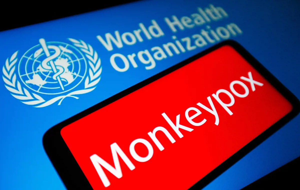 WHO: Megfékezhető a majomhimlő Európában