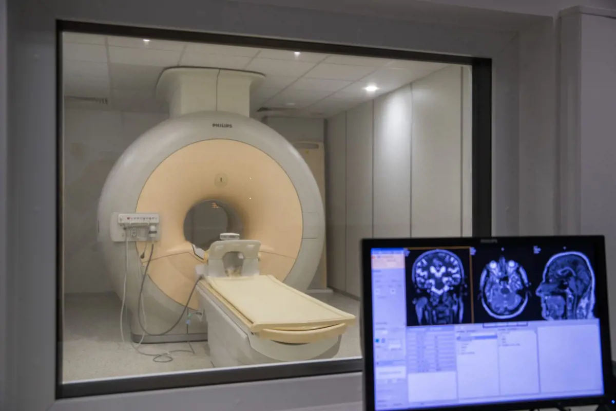 Szakemberhiány: A kisebb kórházakban nincs elég radiológus, aki működtetné a gépeket
