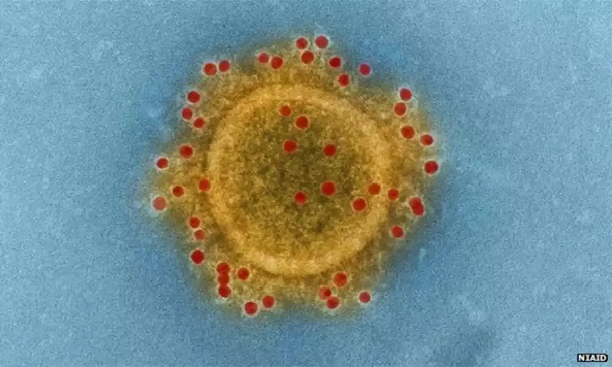Egy 61 éves brazil lehet az első latin-amerikai koronavírus-fertőzött