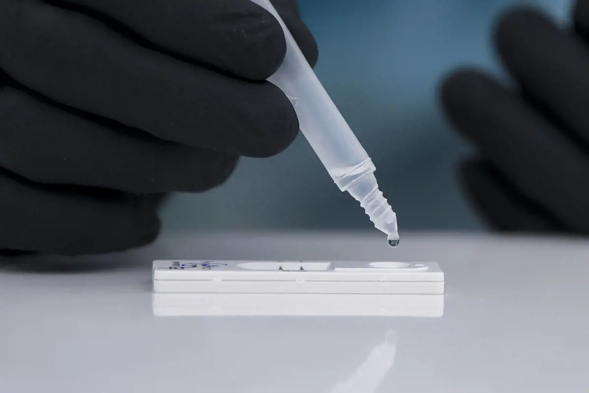 Az egészségügyi szakértő szerint akár egy ostoba bosszú is állhat a fizetős PCR-tesztek mögött